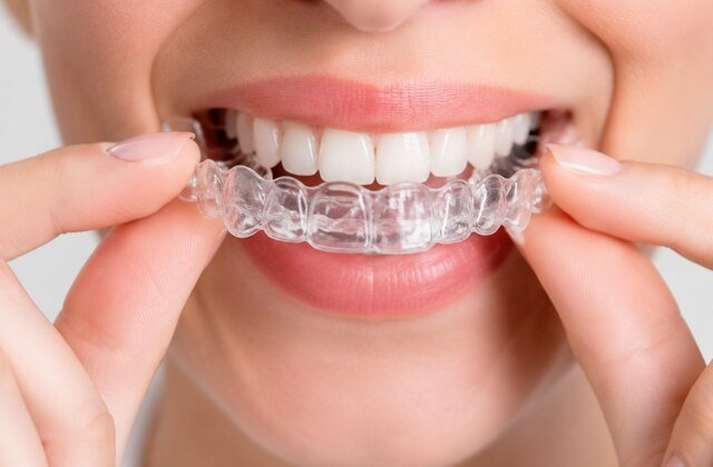 Orthodontie à Marrakech